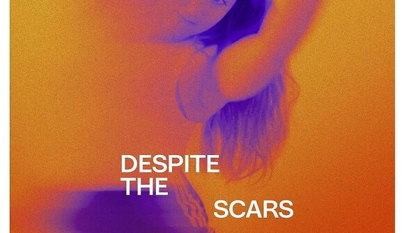Kino: "Despite the Scars"