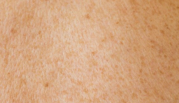 Vortrag: Hautgesundheit im Fokus